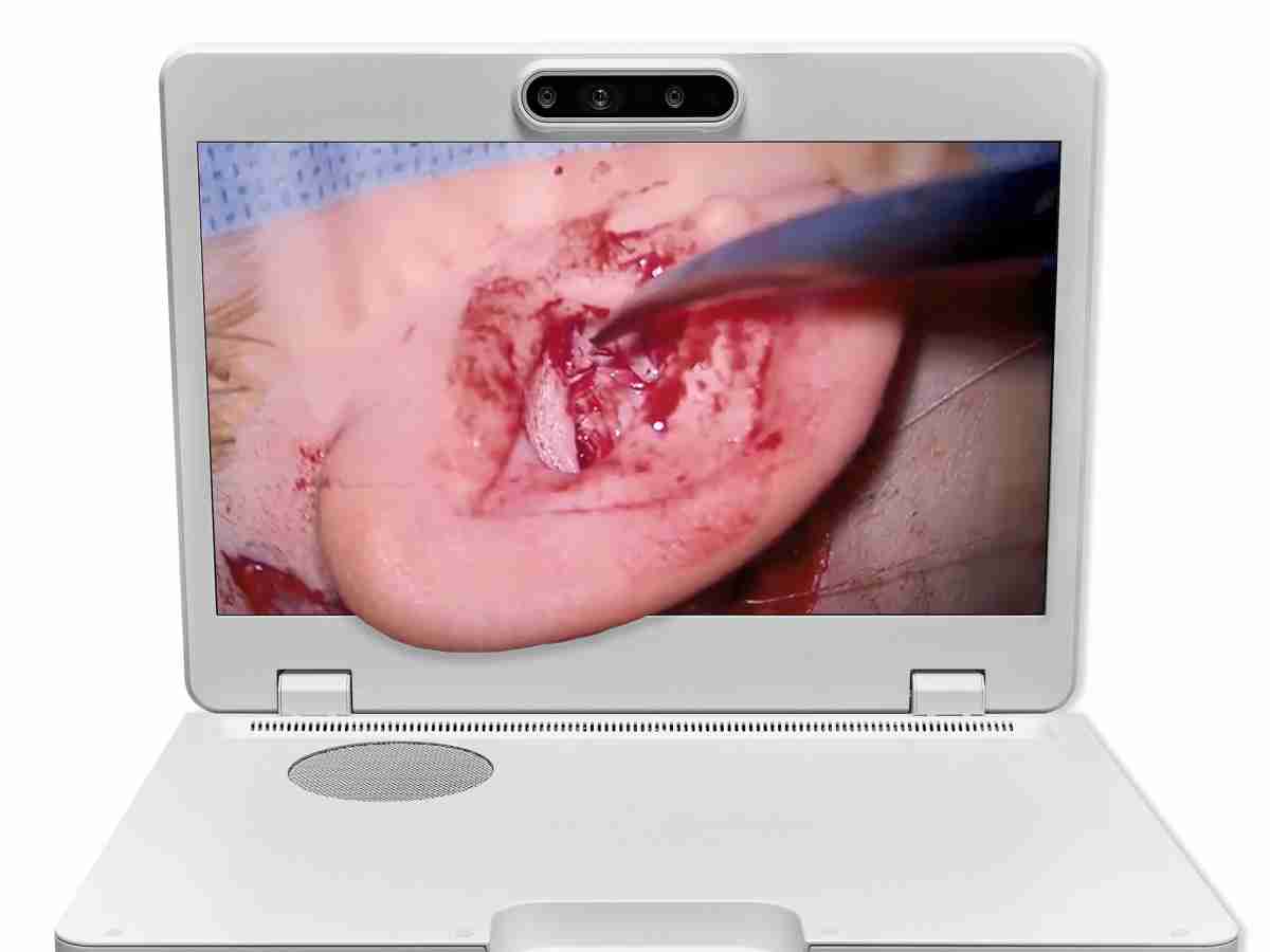 达擎之＂Heads-up 3D显微手术显示系统＂，，，，整合4K裸眼3D显示及眼球追踪系统，，，，具备快速追踪人眼移动位置功能，，，，减轻医师长时间维持固定姿势的负担，，，，让医师能有更宽广清晰的3D立体视野及更舒适的姿势来执行手术。。。